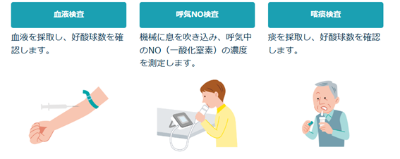 気管支喘息の検査について