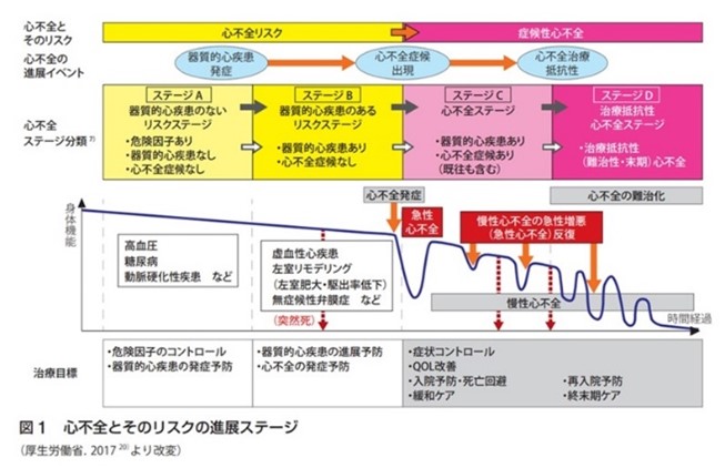 心不全のイメージ画像